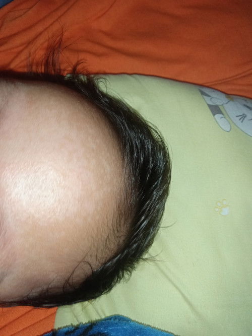 Bisa hilang nggak ya?