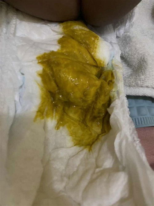 Masalah PUP setelah MPASI