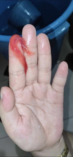 Mucus Plug?