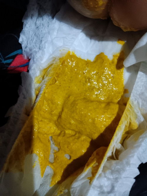 Apakah ini tanda awal diare/mencret?