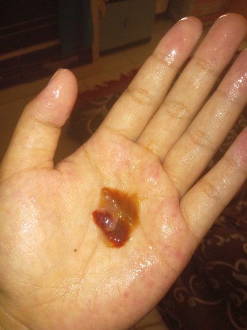 Hpl 2 desember hamilq 37 minggu 2 hari