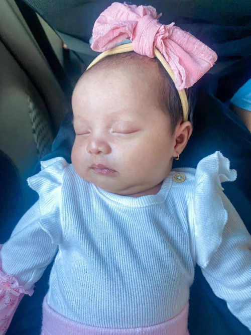 Muka bayi beruntusan