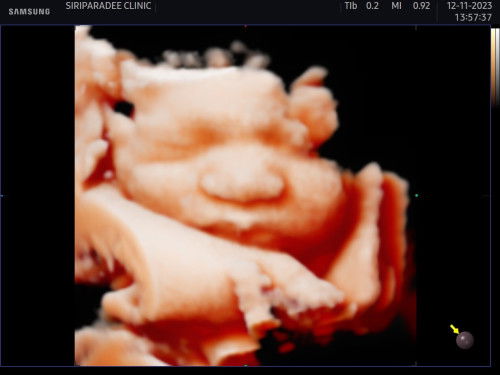 ธีมธันวา นัดหมอผ่า 5 ธันวาแล้วค่ะ☺️