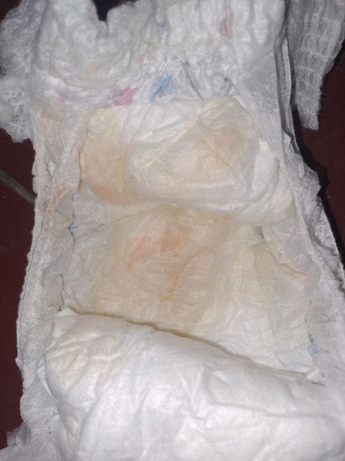 Bercak orange/pink pada bayi