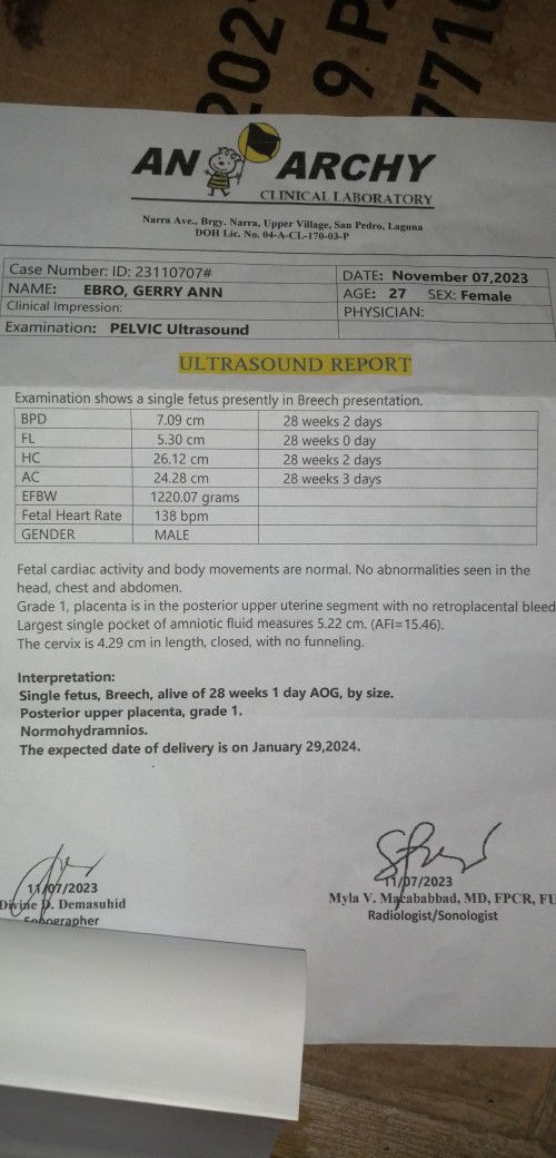 Trans v VS Ultrasounds mga mi