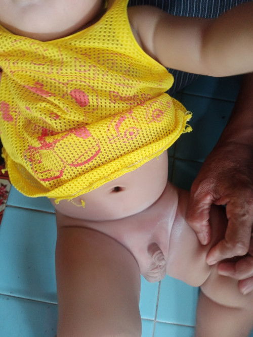 ตรงจุ๊ดจู๋ลูกแดงๆทายาอะไรได้บ้างคะ