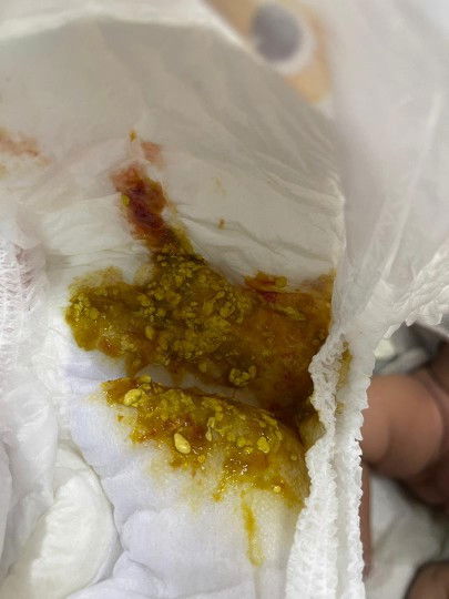 Apa perlu saya lakukan