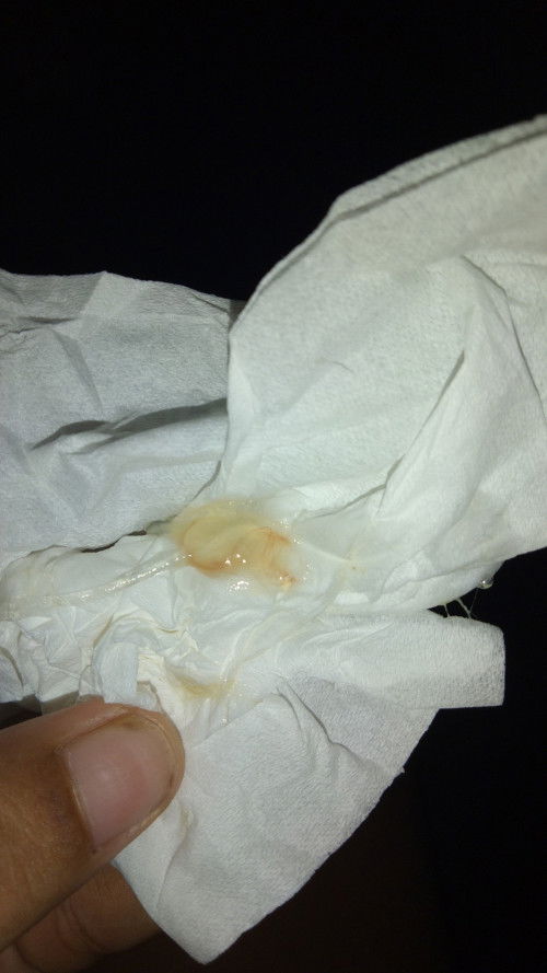 40 Week Keluar Lendir Coklat sedikit