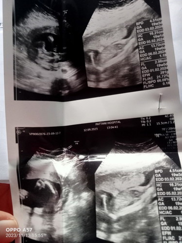 ใครดูเป็นช่วยดูไห้หน่อยค่ะว่า หญิงหรือชาย หมอบอกไม่เห็นค่ะ