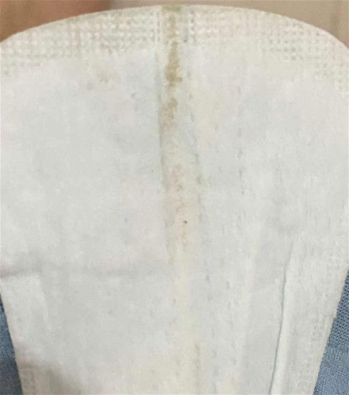 Flek Implantasi atau Apa yaa