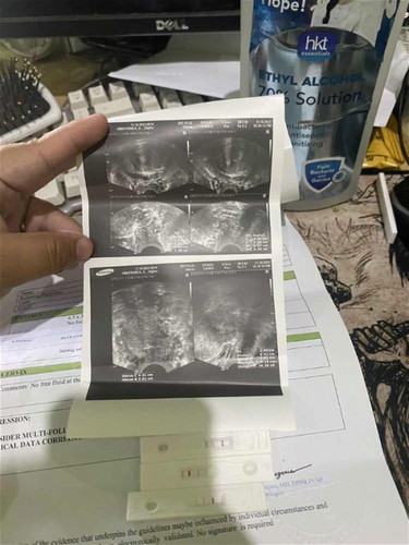 PREGNANT OR NOT