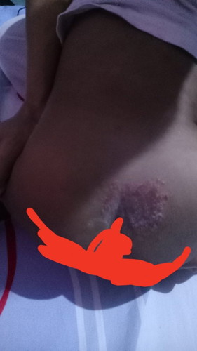 Ano Po kaya pwedeng maigamot Kay baby para Dito ? Nangangati Po sya lagi
