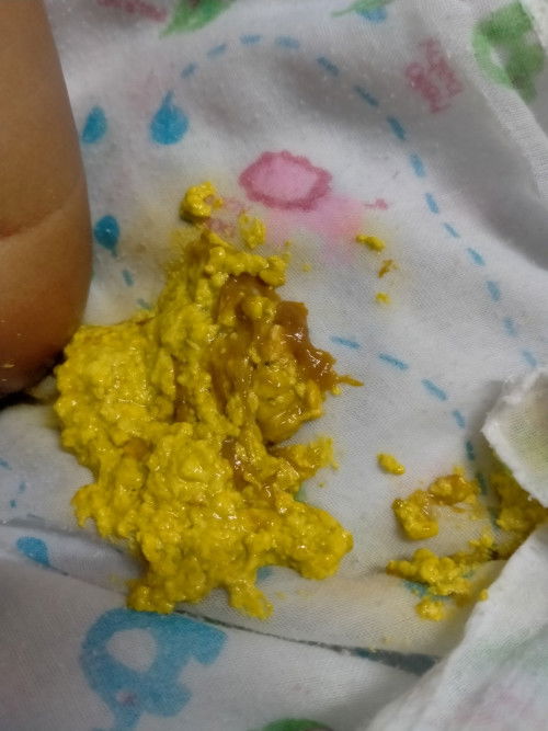 ทานนมผงเอนฟาแล็คสูตร1