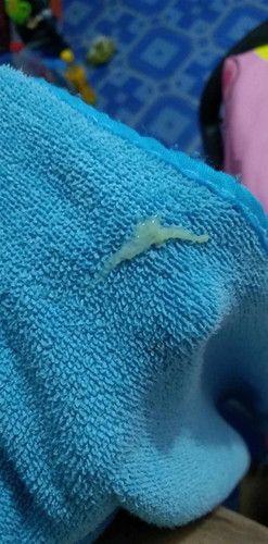 36สัปดา
แบบนี้เค้าเรียกว่าตกขาว
หรื่อมูกค่ะ