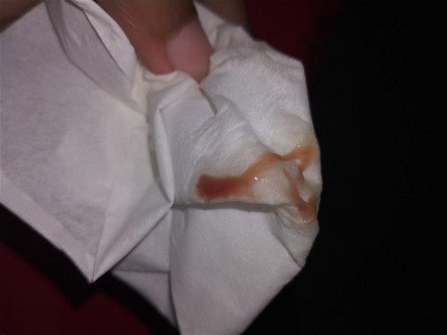 Garis 2 setelah keguguran