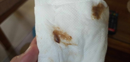 Ano po ba ibig sabihin nito? 2 days na po ako nilalabasan nito.nasa 37 weeks palang Po ako