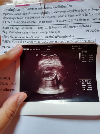 น้ำหนักลูกอายุครรภ์