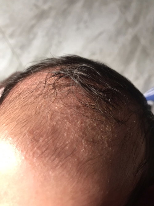 kulit kepala bayi