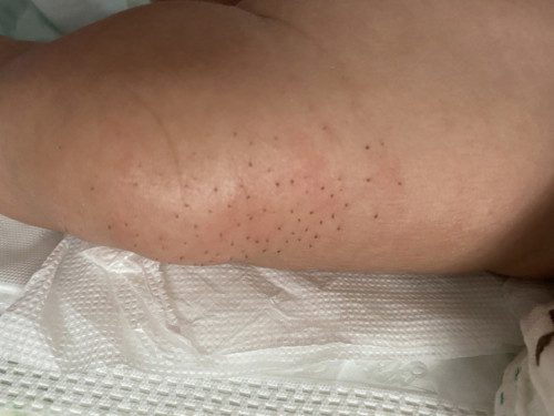 Chân bị như vậy là sao vậy mn?