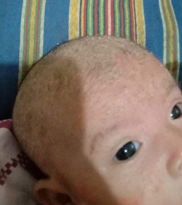 Kepala bayi bekerak