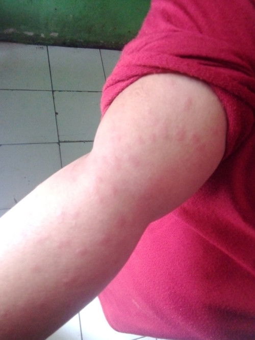 Bun mau tanya dan minta saran dong