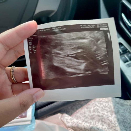 Scan Details Boy or Girl?