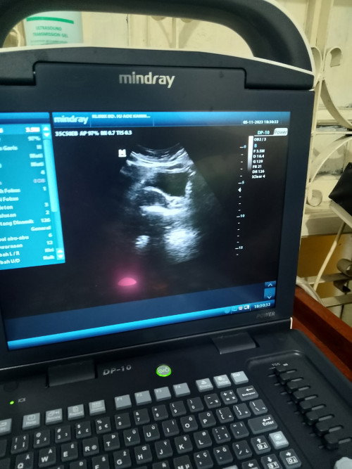 Bayi 5week