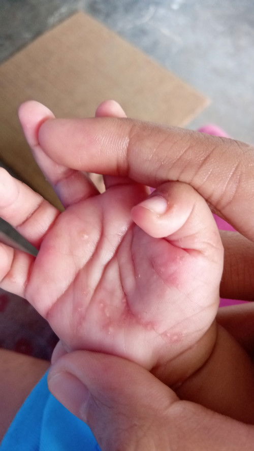 Solusinya dong bund?