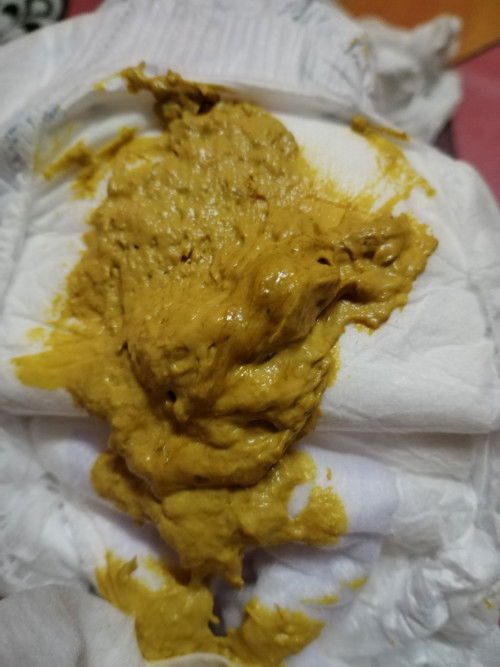 Bayi 3 bulan lebih tanak menyusu