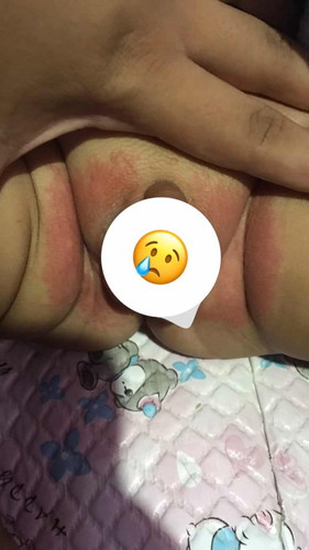 ทำไงถึงจะหายคะแนะนำหน่อย