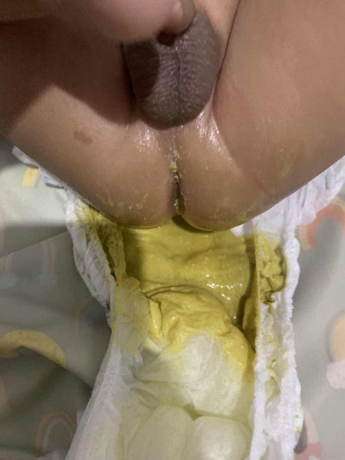 Ciri2 bayi tidak cocok sufor