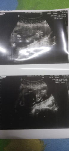 พ่ออยากได้ลูกสาว