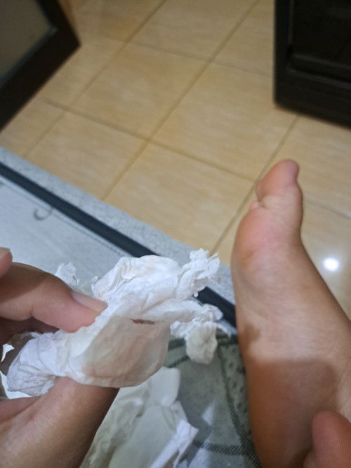 Flek merah muda setelah bak itu normal kah??