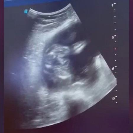 GIRL OR BOY