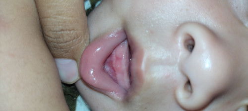 Tumbuh gigi atau bukan