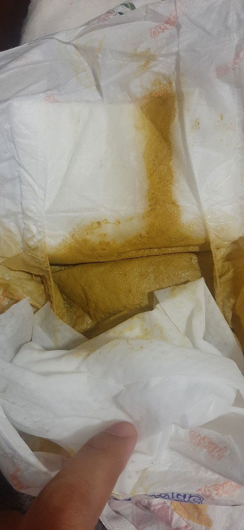 Okay lang ba na ganito PUPU ng mixed feeding? 
1st time MOM ,thanks