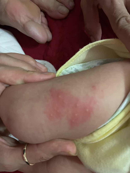 Các mom cho e hỏi bị này là bị gì ạ