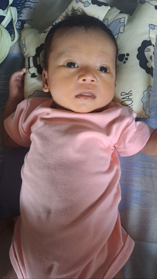 Maaf mau nanya muka anakku usia 17 hari bintik2 putih kayak jerawat batu, ada dari lahir, kenapa ya?