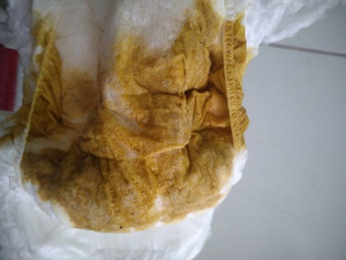 Apakah ini tanda diare?