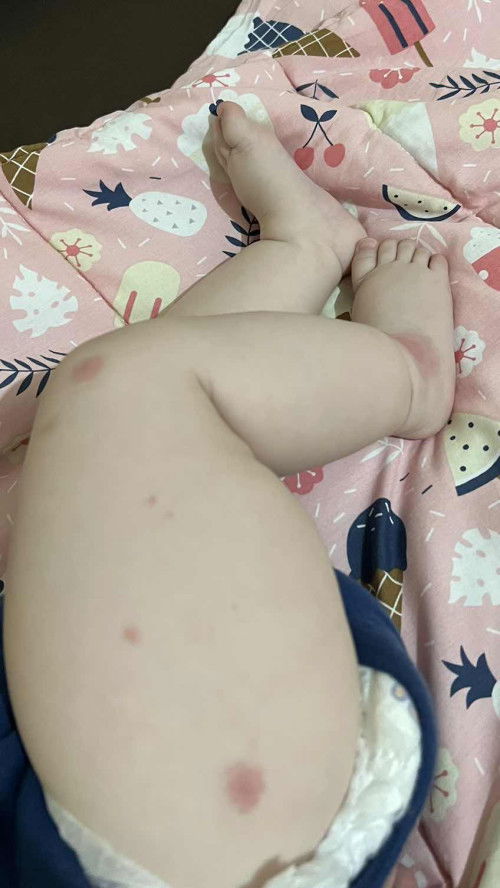 Ini digigit apa yaaa?