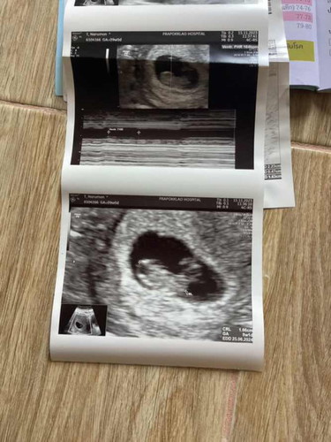 เจอหัวใจน้องเต้นละคะ เจอตัวน้องแล้วดีใจมาก อิอิ หมดนัดวันนี้ 15/11/66ครบ9วีค เจอหัวใจน้องคะ ดีใจจนน้ำตาไหล