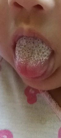 Macam mana nak hilangkan Lidah baby putih tu... #firstmom