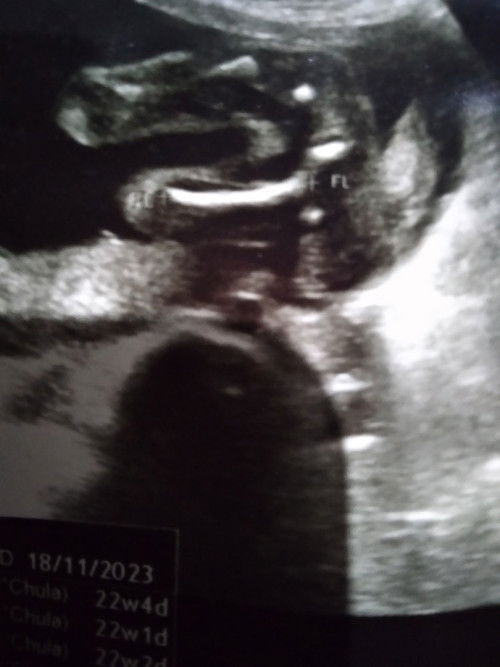 #แม่คะๆคะช่วยดูหน่อยคะชายหรือหญิงคะ ขอบคุนสำหรับคำตอบคะ