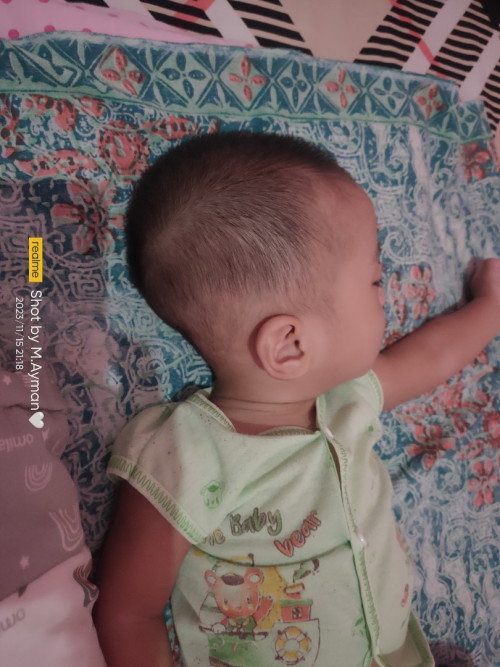 Kepala kelakang bayi