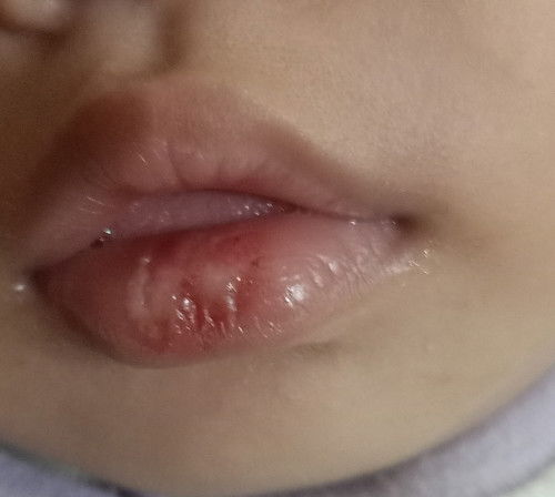 Bunda mohon bantuannya🙏