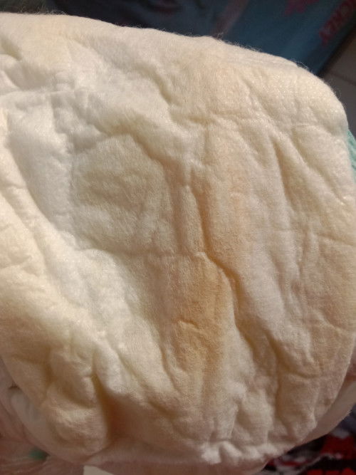 Cara mengatasi dehidrasi gimana bun