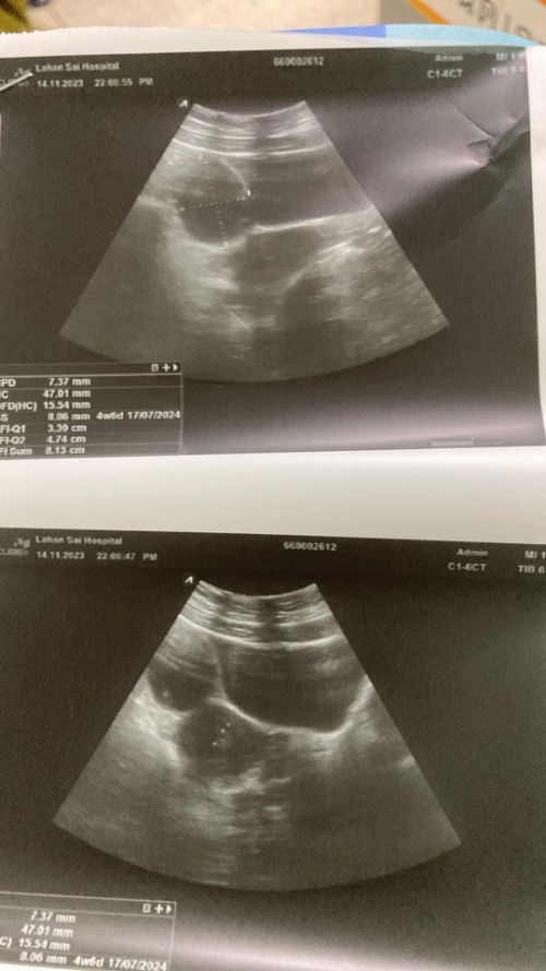 ช่วยแนะนำทีค่ะแม่ๆคนไหนเคยเป็น