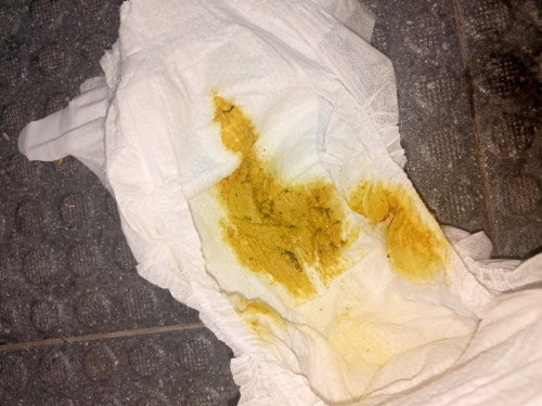 Poop ni baby