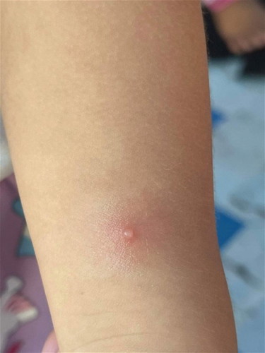 Ano po ito???