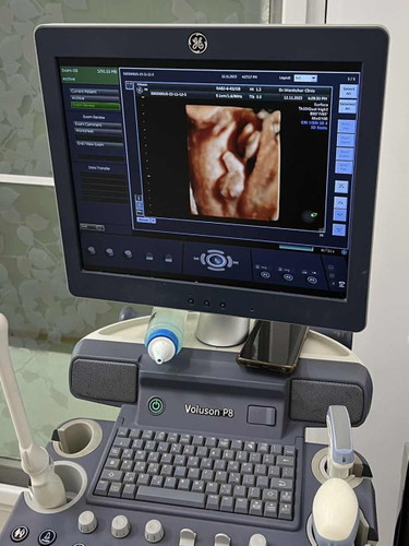 เพศทารกในครรภ์